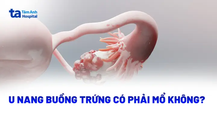 Cá Trứng Có Phải Mổ Không Cá Trứng Có Phải Mổ Không