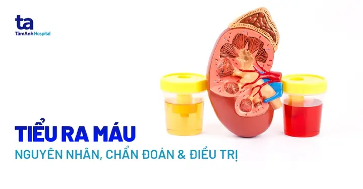 Giảm Cân Có Nên Ăn Thịt Heo? Bí Quyết Chọn Lọc & Chế Biến Giảm Cân Có Nên Ăn Thịt Heo? Bí Quyết Chọn Lọc & Chế Biến