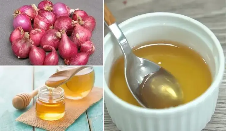 Hành Tím Trộn Mật Ong: Công Thức Chuẩn Từ A Đến Z Hành Tím Trộn Mật Ong: Công Thức Chuẩn Từ A Đến Z