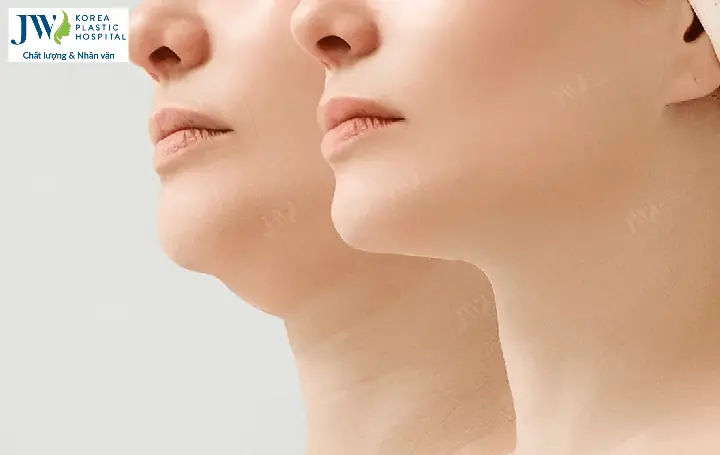 Cằm Tướng Số Cằm Tướng Số