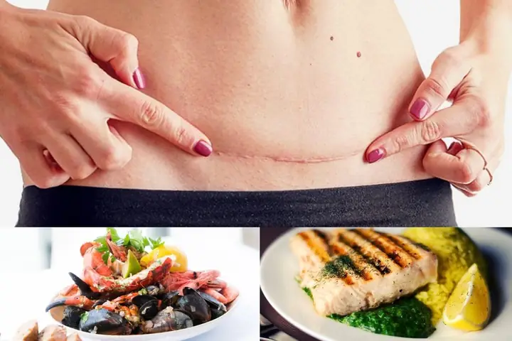 Bà Đẻ Bao Lâu Được Ăn Hải Sản Bà Đẻ Bao Lâu Được Ăn Hải Sản