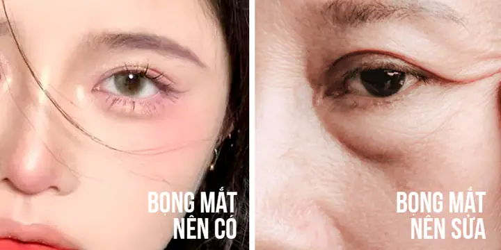 Bọng Mắt To Tướng Số Bọng Mắt To Tướng Số