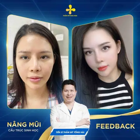 Các Tướng Mũi Giàu Sang Các Tướng Mũi Giàu Sang