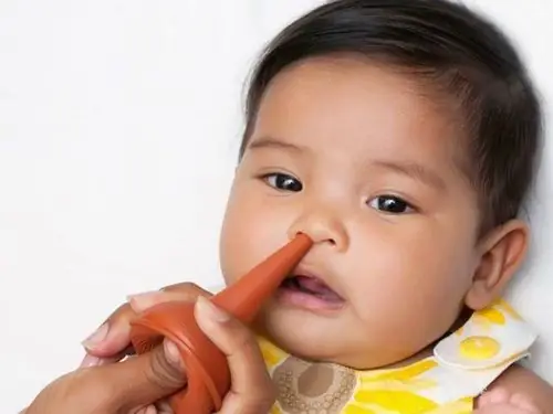 Cách Hút Mũi Cho Trẻ 6 Tháng Tuổi Cách Hút Mũi Cho Trẻ 6 Tháng Tuổi