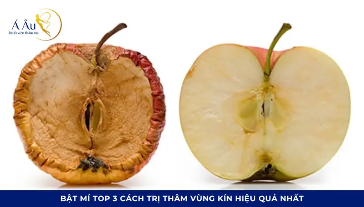 Cách Trị Vùng Kín Bị Thâm Đen