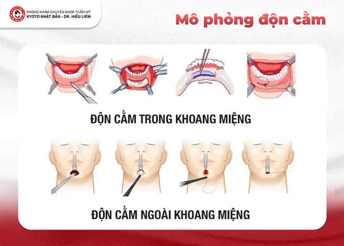 Cằm Ngắn Tướng Số Cằm Ngắn Tướng Số