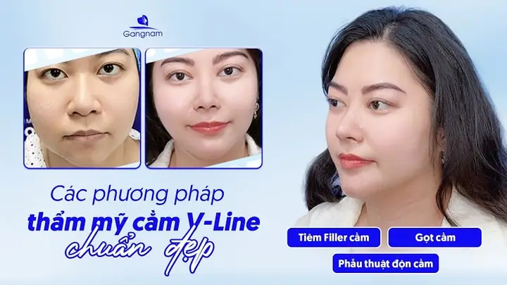 Cằm Nhọn Tướng Số Cằm Nhọn Tướng Số