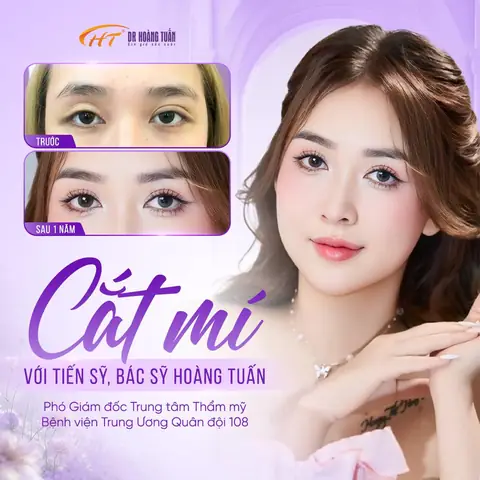 Cắt Mí Mắt Có Ảnh Hưởng Đến Tướng Số Không Cắt Mí Mắt Có Ảnh Hưởng Đến Tướng Số Không