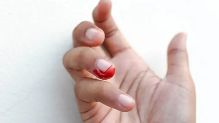 Cắt Móng Tay Cho Bé Bị Chảy Máu Cắt Móng Tay Cho Bé Bị Chảy Máu