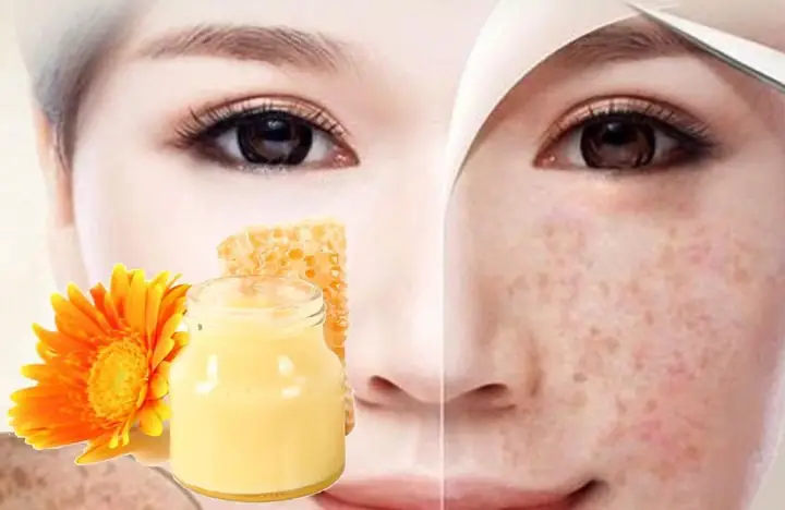 Công Dụng Của Sữa Ong Chúa Với Da Công Dụng Của Sữa Ong Chúa Với Da