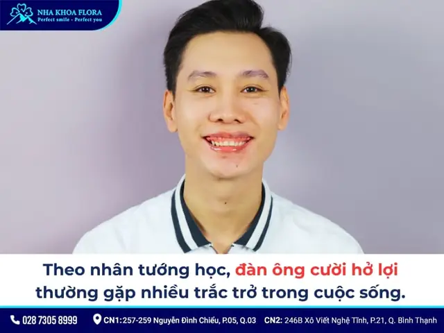 Cười Hở Lợi Tướng Số Nam