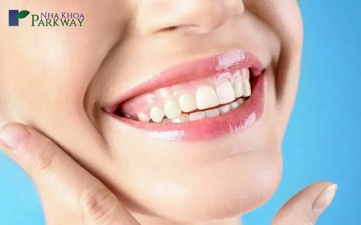 Cười Hở Lợi Tướng Số Nam