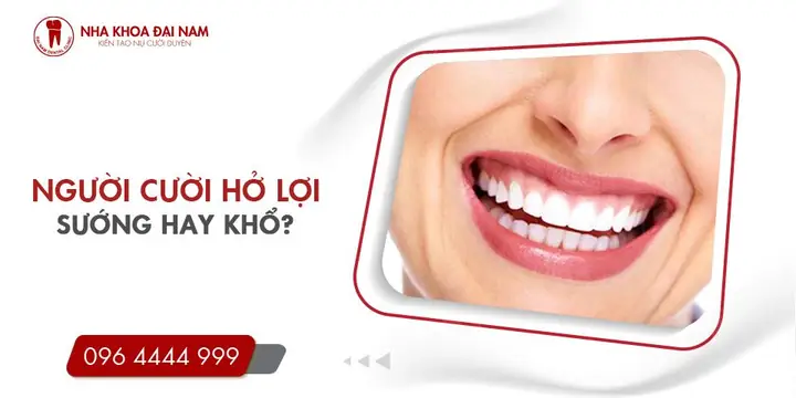 Cười Hở Lợi Tướng Số Nam