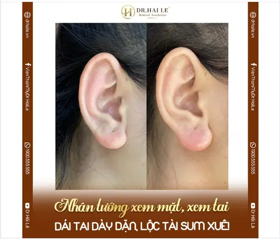 Dái Tai Tướng Số Dái Tai Tướng Số