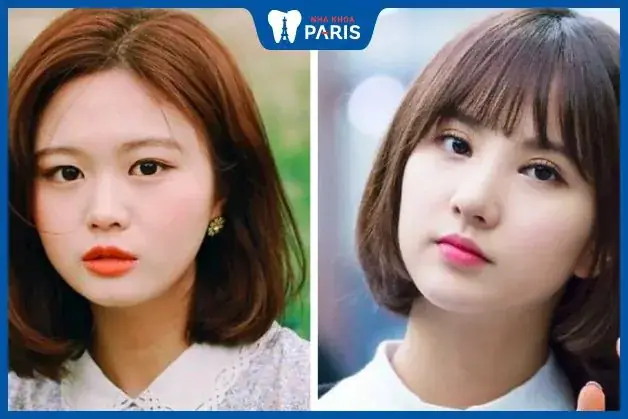 Guognw Mặt Và Tướng Số Guognw Mặt Và Tướng Số