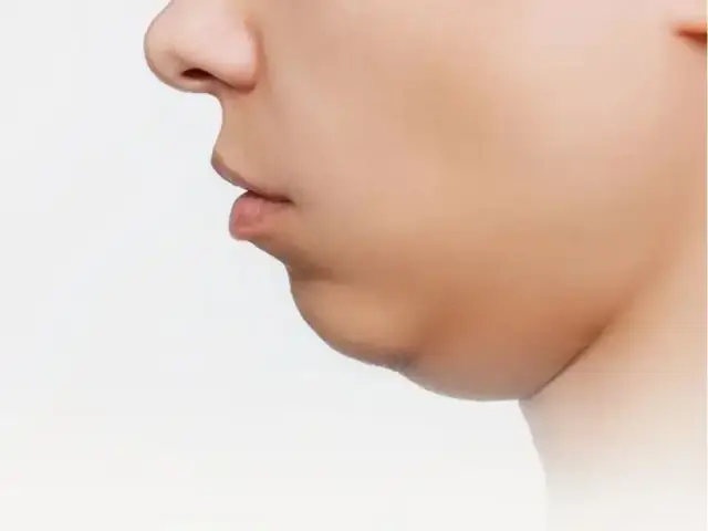 Hai Cằm Trong Tướng Số Hai Cằm Trong Tướng Số