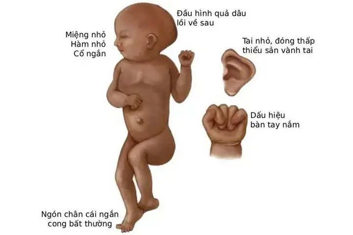Hỏi Gì Khi Xem Tướng Số Hỏi Gì Khi Xem Tướng Số