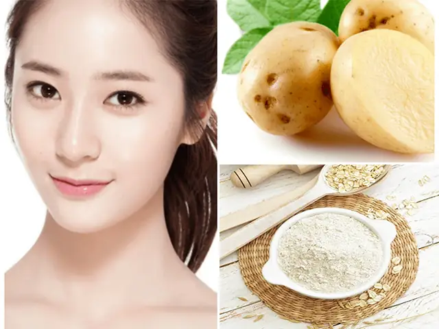 Khoai Tây Đắp Mặt Trị Mụn Khoai Tây Đắp Mặt Trị Mụn