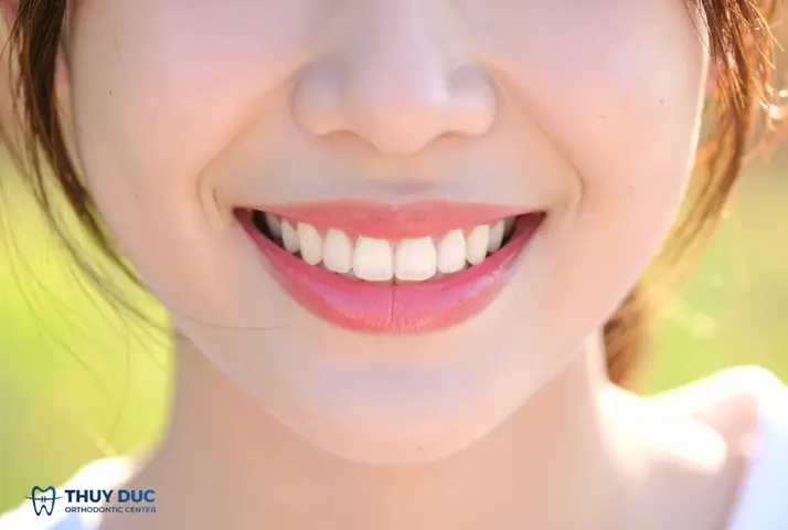 Làm Răng Có Thay Đổi Tướng Số Làm Răng Có Thay Đổi Tướng Số
