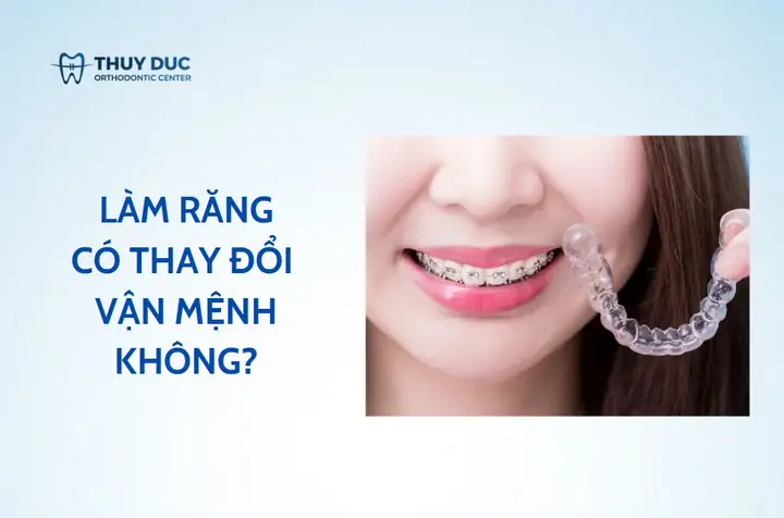 Làm Răng Có Thay Đổi Tướng Số Làm Răng Có Thay Đổi Tướng Số