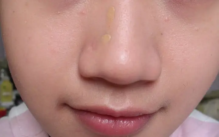 Lỗ Mũi To Tướng Số Lỗ Mũi To Tướng Số