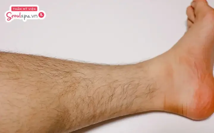 Lông Chân Ở Nam Tướng Số Lông Chân Ở Nam Tướng Số