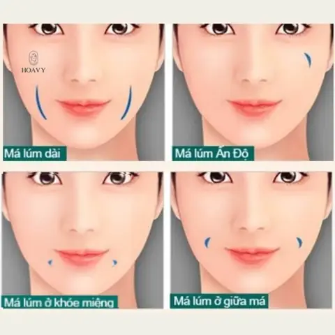 Lúm Đồng Tiền Theo Tướng Số Lúm Đồng Tiền Theo Tướng Số