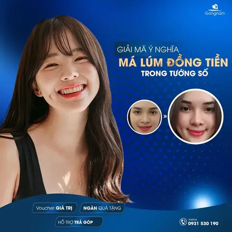 Lúm Đồng Tiền Theo Tướng Số Lúm Đồng Tiền Theo Tướng Số