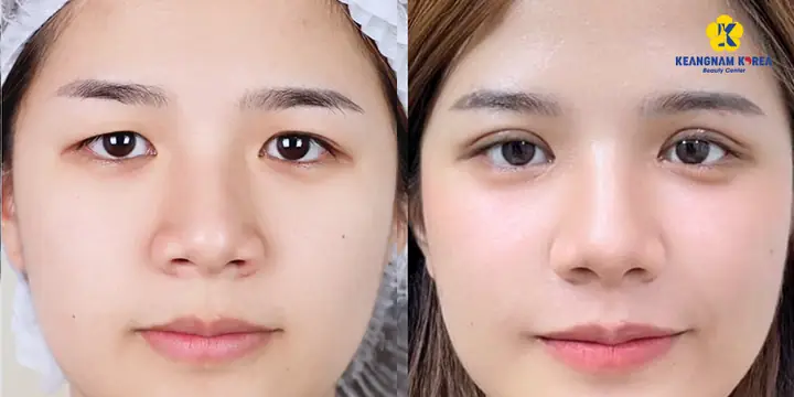Mắt Lệch Mí Tướng Số Mắt Lệch Mí Tướng Số