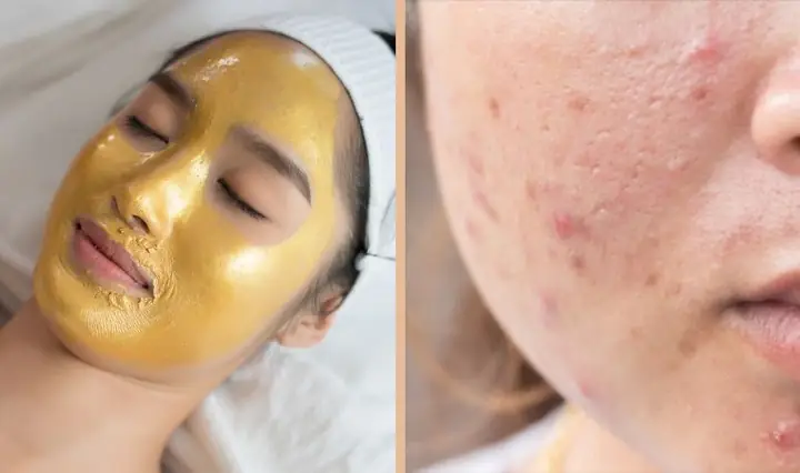 Mặt Nạ Ngủ Dành Cho Da Dầu Mụn Mặt Nạ Ngủ Dành Cho Da Dầu Mụn