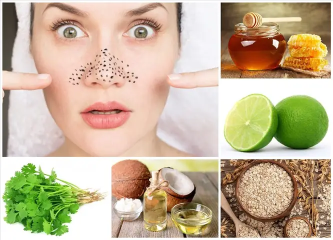 Mặt Nạ Trị Mụn Đầu Đen Hiệu Quả Nhất