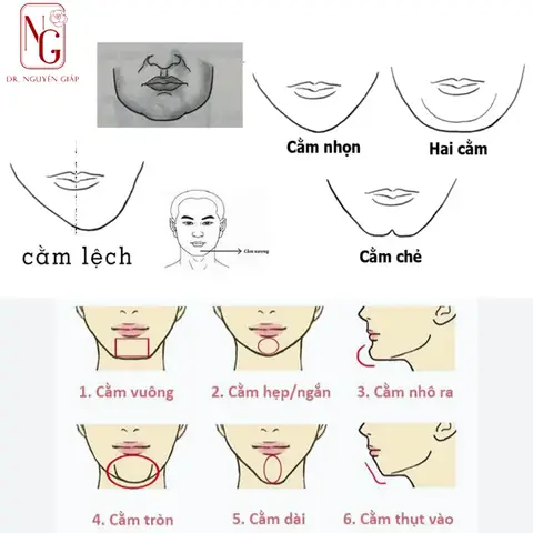 Mặt Nọng Tướng Số Mặt Nọng Tướng Số