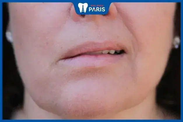 Miệng Méo Tướng Số Miệng Méo Tướng Số