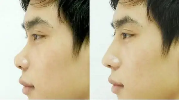 Mũi Ngắn Tướng Số Mũi Ngắn Tướng Số