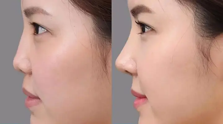 Mũi Ngắn Tướng Số Mũi Ngắn Tướng Số