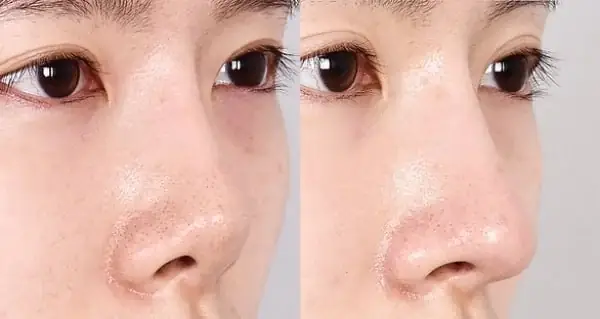 Mũi Ngắn Tướng Số Mũi Ngắn Tướng Số