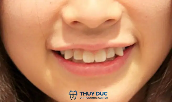 Nam Giới Tướng Răng Nào Là Đẹp Nhất Nam Giới Tướng Răng Nào Là Đẹp Nhất