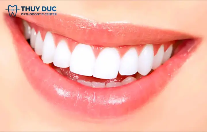 Nam Giới Tướng Răng Nào Là Đẹp Nhất Nam Giới Tướng Răng Nào Là Đẹp Nhất
