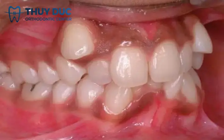 Nam Giới Tướng Răng Nào Là Đẹp Nhất Nam Giới Tướng Răng Nào Là Đẹp Nhất