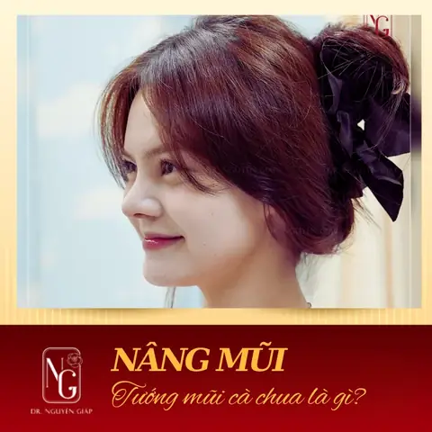 Nâng Mũi Và Tướng Số Nâng Mũi Và Tướng Số