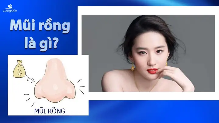 Người Có Tướng Mũi Vẹo Đ Người Có Tướng Mũi Vẹo Đ