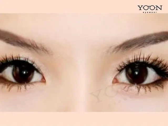 Nhân Tướng Mặt Nhiều Lông Tơ Nhân Tướng Mặt Nhiều Lông Tơ