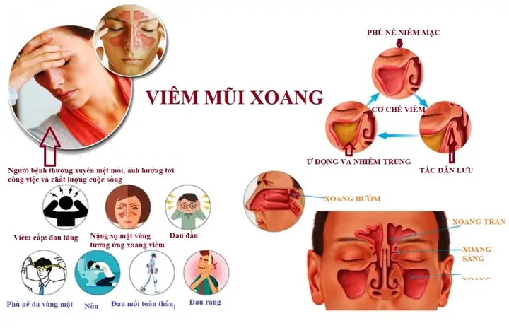 Những Thói Quen Xấu Về Mặt Tướng Số Những Thói Quen Xấu Về Mặt Tướng Số