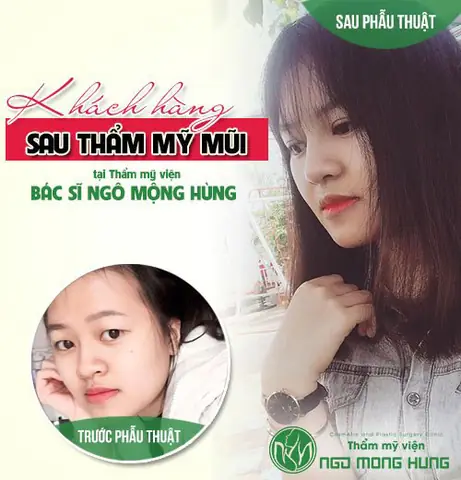 Phẫu Thuật Thẩm Mỹ Có Thay Đổi Tướng Số