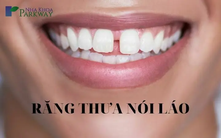 Răng Thưa Hàm Trên Tướng Số Răng Thưa Hàm Trên Tướng Số