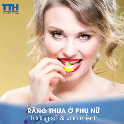 Răng Thưa Hàm Trên Tướng Số Răng Thưa Hàm Trên Tướng Số
