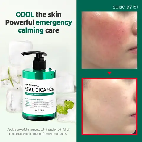 Review Kem Dưỡng Ẩm Some By Mi