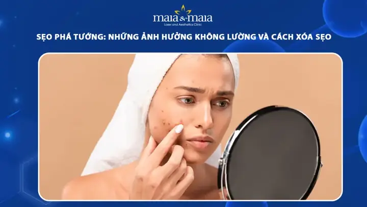 Sẹo Ở Mũi Tướng Số Sẹo Ở Mũi Tướng Số