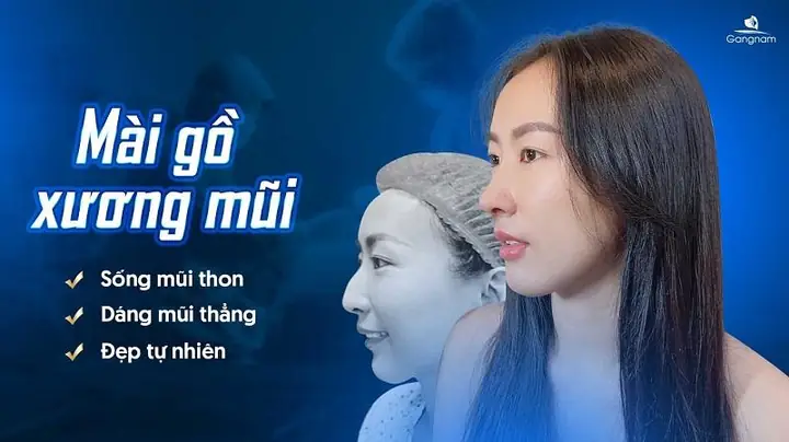 Sống Mũi Gồ Tướng Số Sống Mũi Gồ Tướng Số