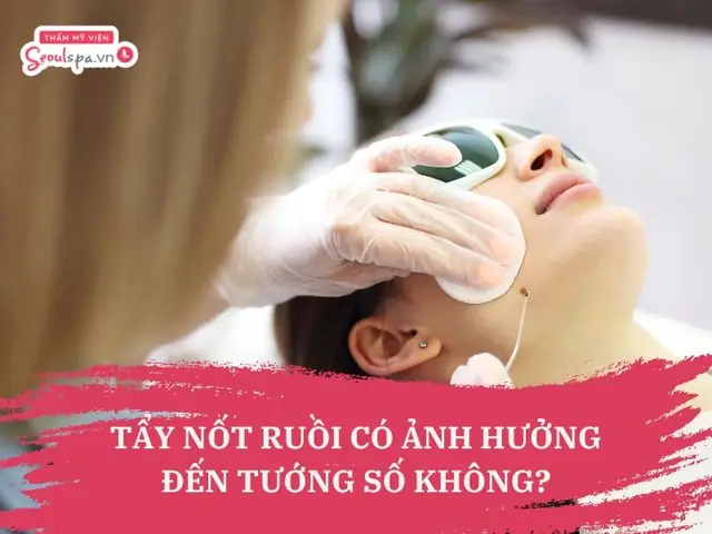 Tẩy Nốt Ruồi Có Ảnh Hưởng Đến Tướng Số Không